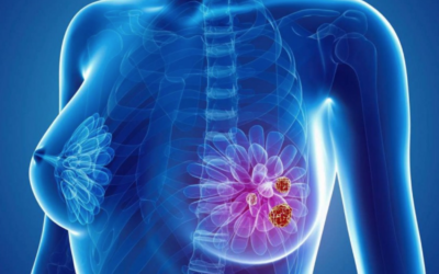 Thank you 1 Traditional Chinese Medicine’s popularity among breast cancer patients worldwide